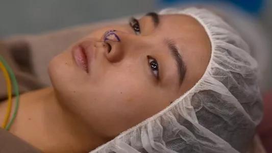 Poster del episodio 4 de Belleza plástica online